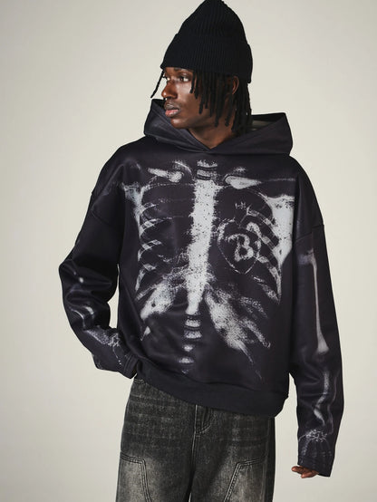 Oversized Skeleton X-Ray Graphic Hoodie